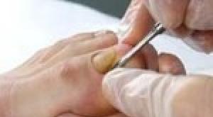 What is mycosis on the nails Treatment of mycosis of the nails